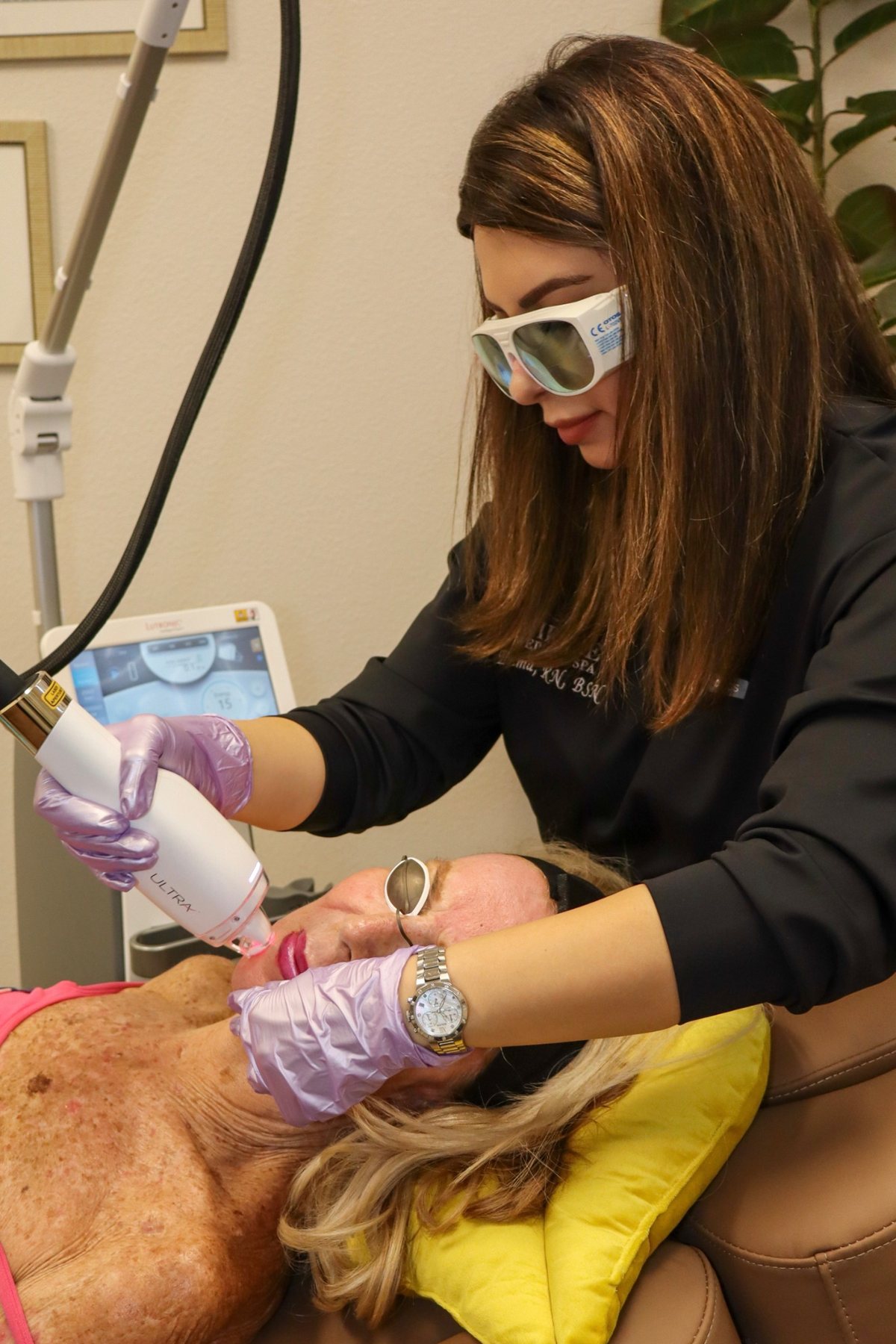 Ultra laser skin rejuvenation treatment at Mirage Medical Spa